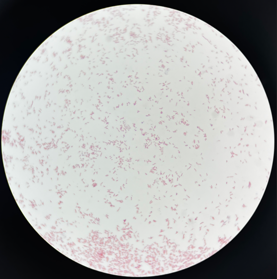 制藥行業中的隱形殺手-洋蔥伯克霍爾德菌群