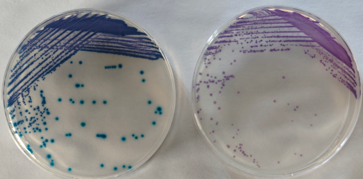 沙門檢測新助手—沙門氏+顯色培養(yǎng)基