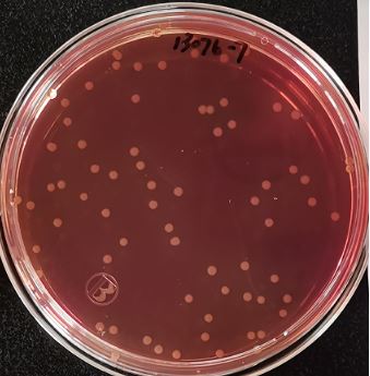 VRBA內(nèi)的紅色小菌落，有可能是沙門氏菌？